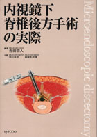 内視鏡下脊椎後方手術の実際