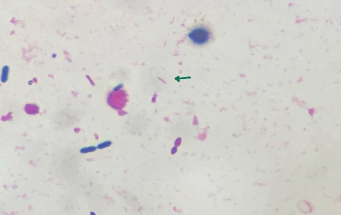 図8-2 矢印：カンピロバクターの菌体