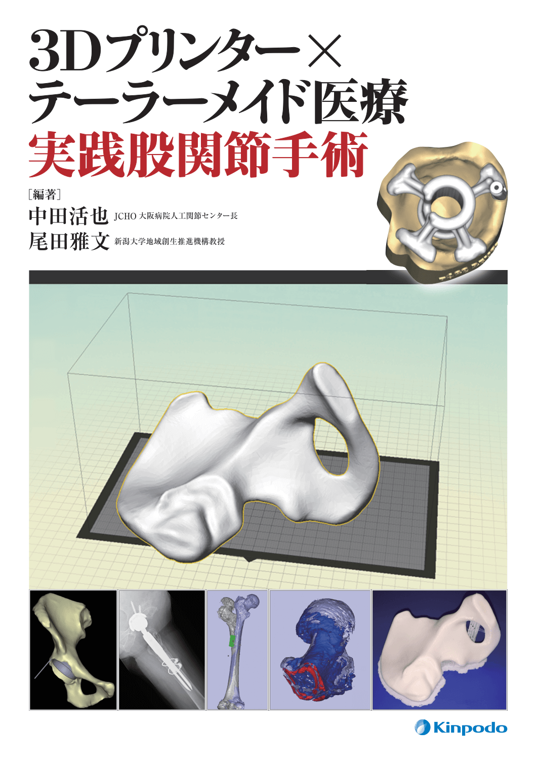 3dプリンター テーラーメイド医療 実践股関節手術 株式会社 金芳堂