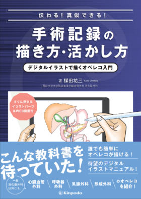 伝わる 真似できる 手術記録の描き方 活かし方 デジタルイラストで描くオペレコ入門 株式会社 金芳堂