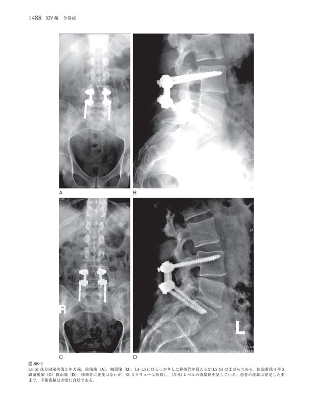 Rothman-Simeone The Spine　脊椎・脊髄外科　見本ページ