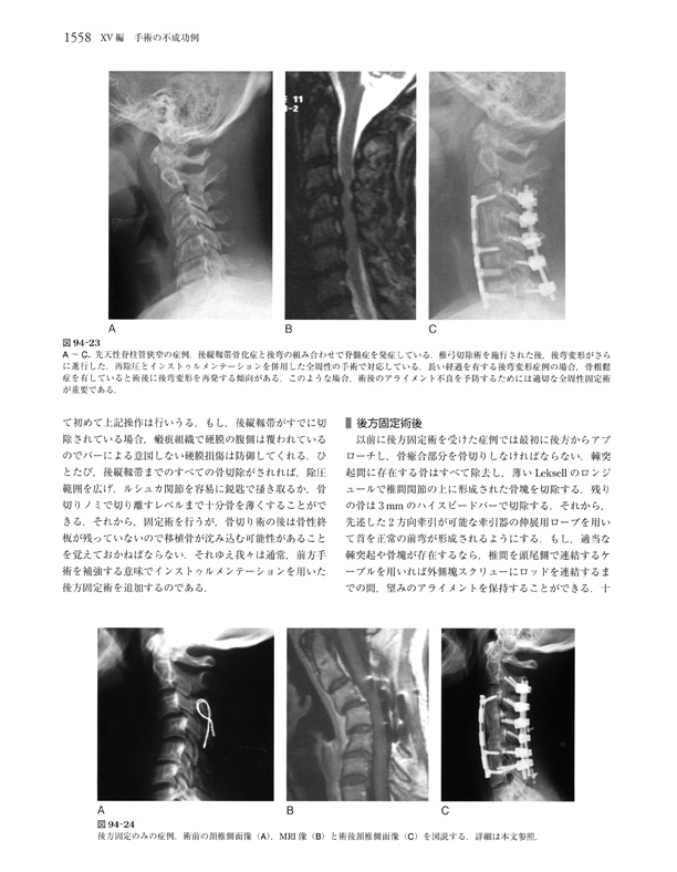 Rothman-Simeone The Spine　脊椎・脊髄外科　見本ページ